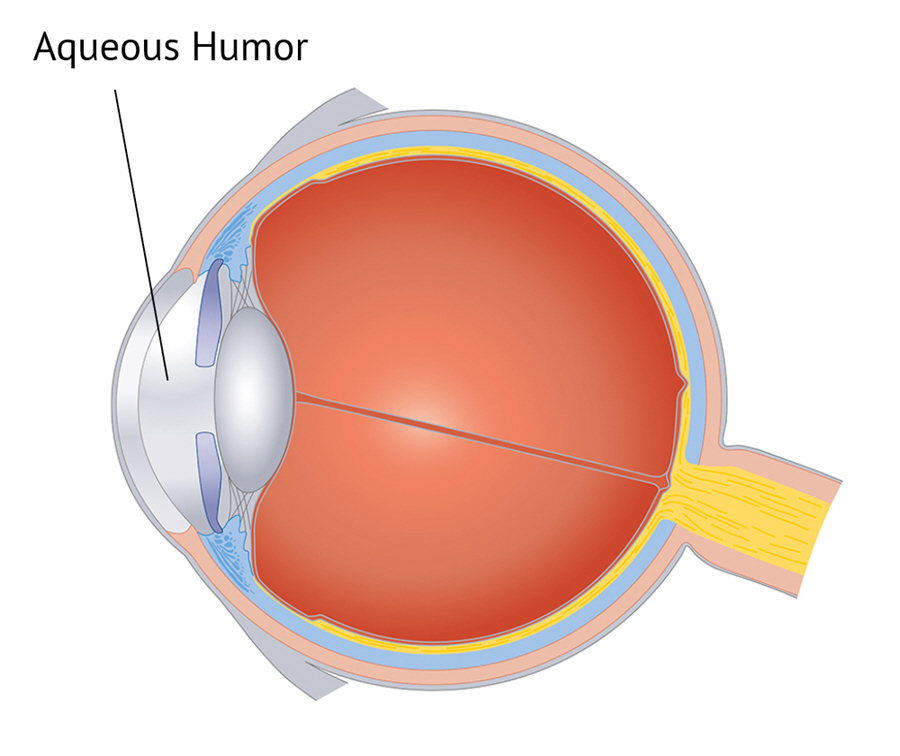 Aqueous Humor Eye Patient